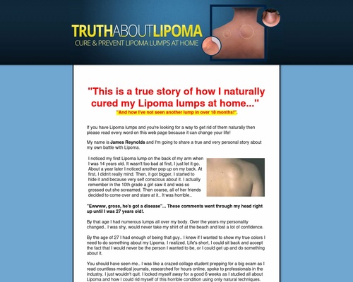 New! - Truth About Lipoma. High Conversions + 75% Commission!